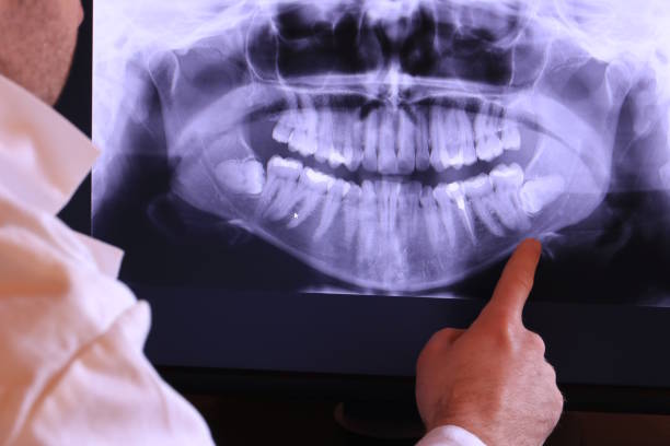 Best Cracked Tooth Emergency Dentist  in Baileyton, AL