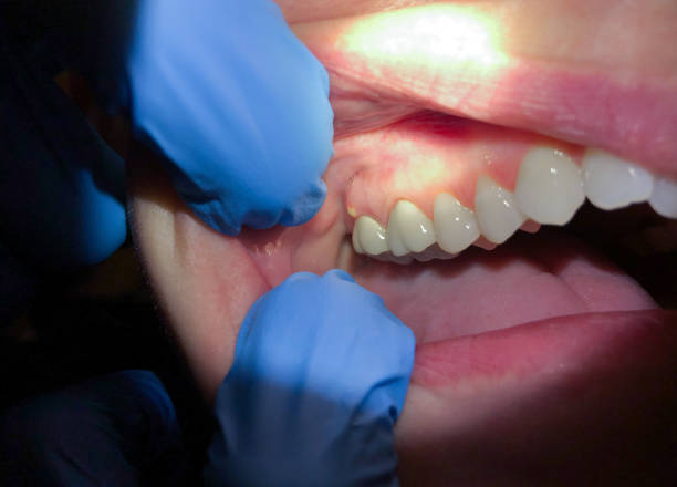 Best Cracked Tooth Emergency Dentist  in Baileyton, AL
